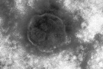 麻疹ウイルスの画像＝東京都健康安全研究センター提供