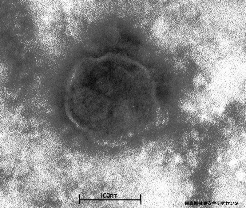 麻疹ウイルスの画像＝東京都健康安全研究センター提供