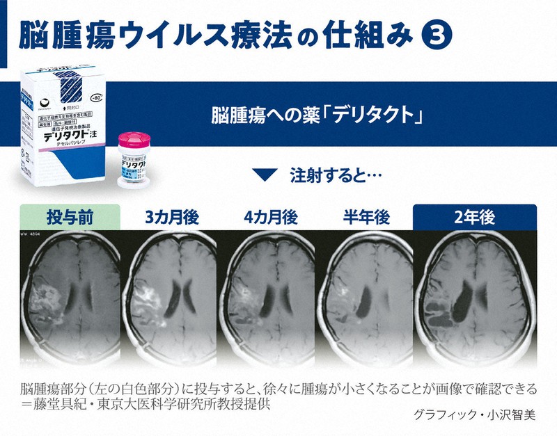 ヒト癌ウイルス探究 ヒト癌ウイルス探究 [978-4-585-24000-6] - 3,080円 : 株式会社
