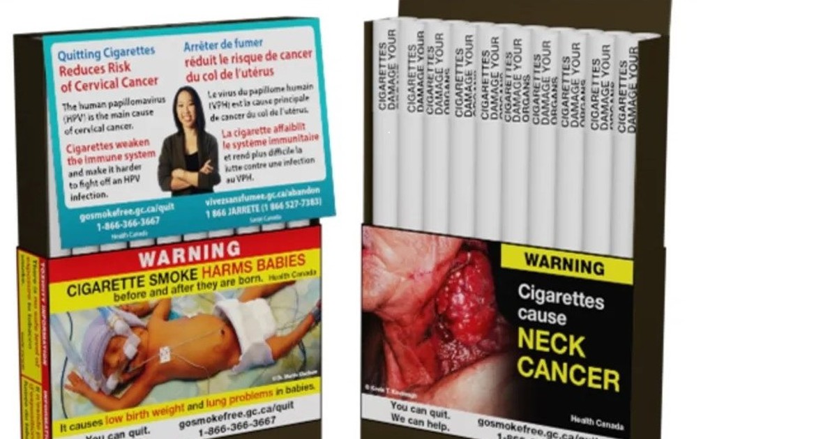 カナダ保健省心電図ライセンス