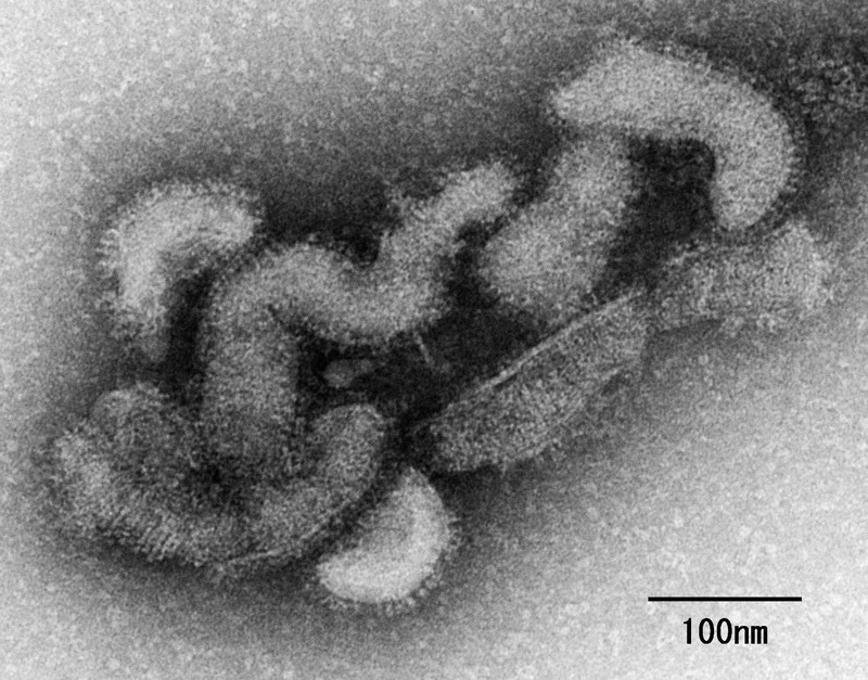 死性病　位置原光z クサダ 黒咲練導 随時　panpanya 平方イコルスン マダニが媒介「オズウイルス」に感染、女性死亡 発症報告は世界初