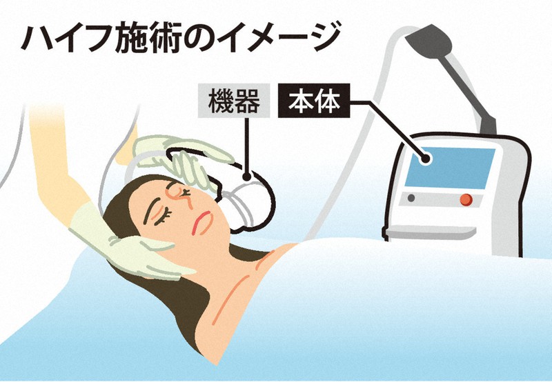 美顔器  ハイフ Vmax  エステ 顔 体 どちらにも使えます 美容機器 美顔器 ハイフ Vmax エステ 顔 体 どちらにも使えます 美容機器 美顔器