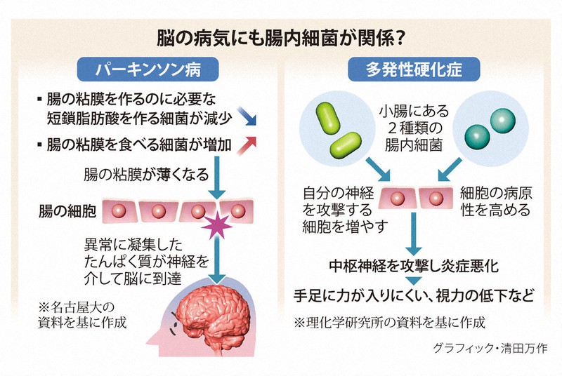 100歳ご長寿は持っている?腸内細菌の底知れぬ力 脳の病と関連も