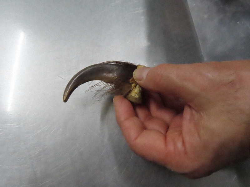 クマ外傷・実態を聞く：／上 保護具の開発、早急に 重傷負った秋田の