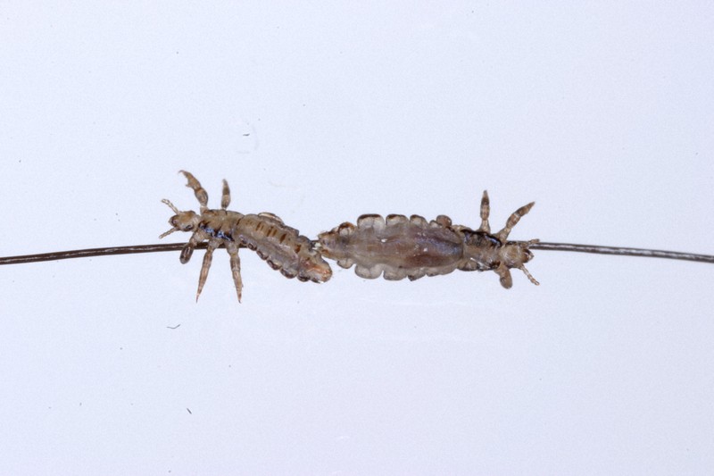 アタマジラミを予防する方法