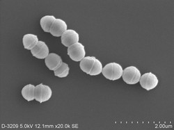 劇症型溶血性連鎖球菌感染症の原因菌となるA群溶血性連鎖球菌＝国立感染症研究所提供