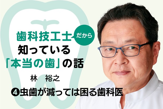 歯科技工士だから知っている「本当の歯」の話：➃虫歯が減っては困る