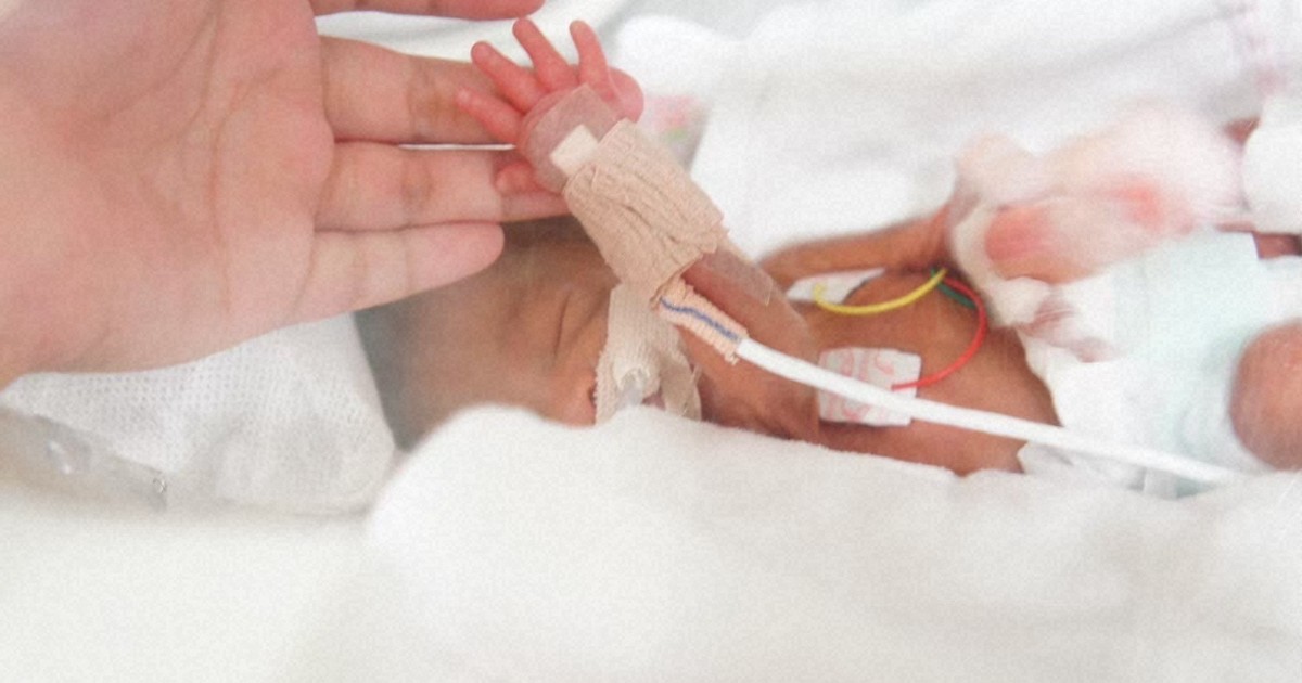 洋書 NURTURING THE PREMATURE INFANT Breathe, Baby, Breathe!: Neonatal Intensive Care