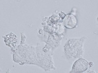 This image shows killer T cells made from hESCs attacking cells mimicking those infected by the coronavirus. The granular matter are cells that have already been destroyed. (Photo courtesy of Kyoto University's Institute for Life and Medical Sciences)