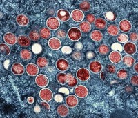 This undated image provided by the National Institute of Allergy and Infectious Diseases shows a colorized transmission electron micrograph of monkeypox particles, red, found within an infected cell, blue, cultured in the laboratory that was captured and color-enhanced at the NIAID Integrated Research Facility in Fort Detrick, Md. (NIAID via AP, File)