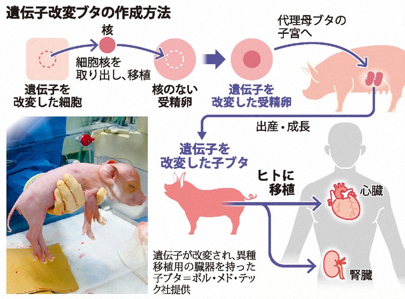 異種移植―21世紀の驚異の医療 異種移植―21世紀の驚異の医療 山内 一也 Amazon.co.jp: 異種