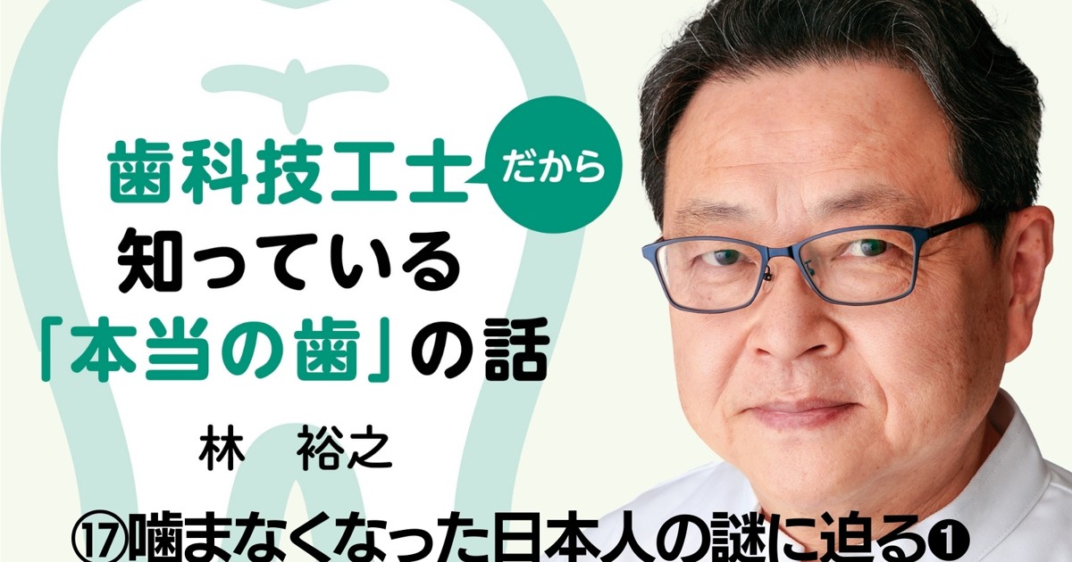 歯科技工士だから知っている「本当の歯」の話：⑰噛まなくなった日本人