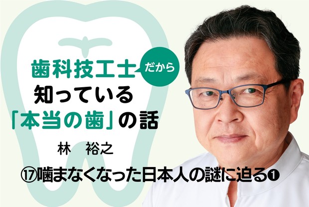 歯科技工士だから知っている「本当の歯」の話：⑰噛まなくなった日本人