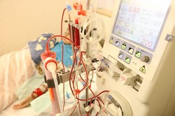 人工透析を受ける女性。大量の血液を体から出し入れするため、終了後は体がだるくなるという＝長崎市で２０１７年、堀井恵里子撮影