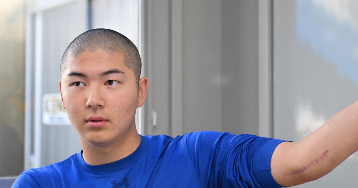 高校野球を捨てても…」 球児にも広がるトミー・ジョン手術/上 | 毎日新聞