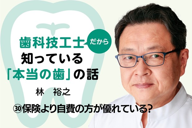 歯科技工士だから知っている「本当の歯」の話：㉚保険より自費の方が