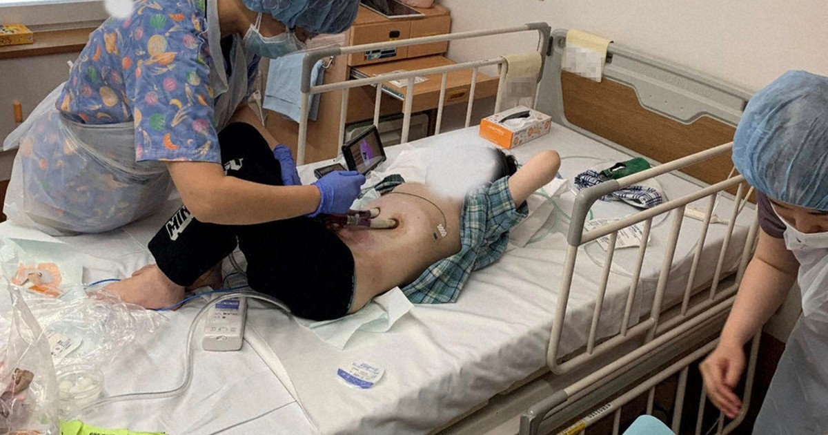 体外人工心臓で命つなぎ 筑波大病院「単心室症候群」の男児 3年待った