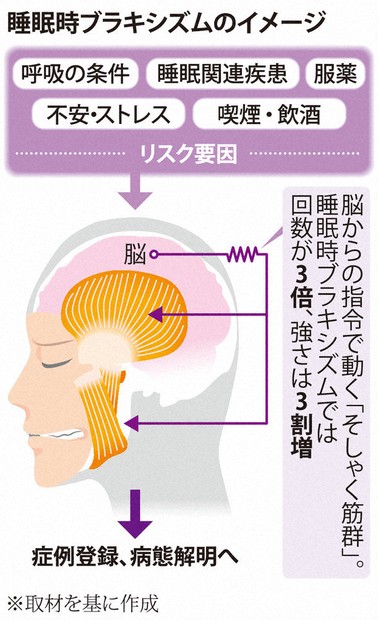どうすれば安全安心：睡眠時の歯ぎしりやかみしめ 個別の原因