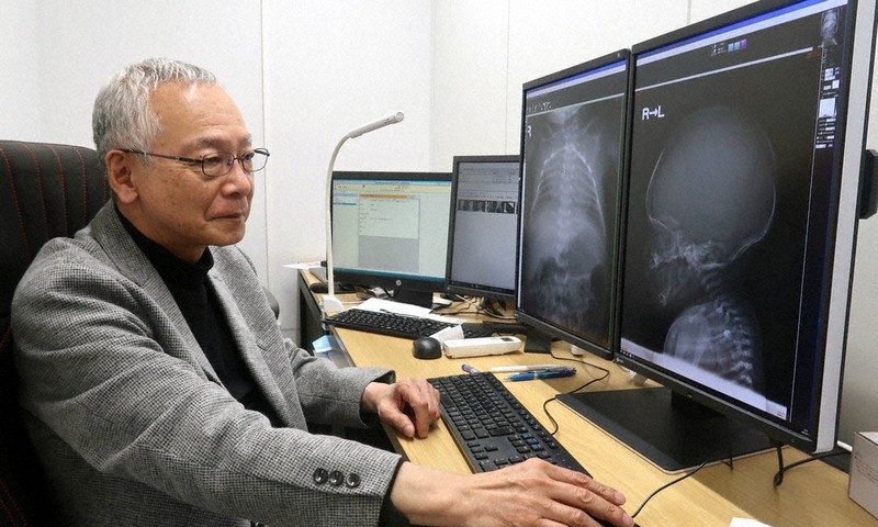 24色のペン：骨の難病見抜くスペシャリスト 画像と向き合い、無償の