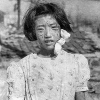 顔一面を負傷した少女。当時10歳だった藤井幸子さんだったことが2017年に判明＝広島市で1945年8月9日、国平幸男撮影