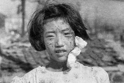 顔一面を負傷した少女。当時10歳だった藤井幸子さんだったことが2017年に判明=広島市で1945年8月9日、国平幸男撮影