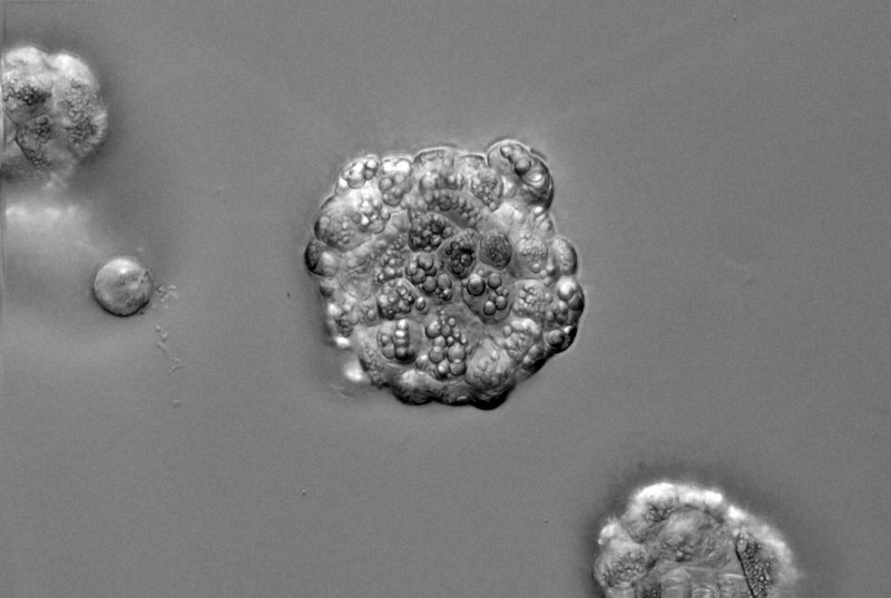 肝臓の主要機能を持つ「ミニ臓器」 慶応大と大阪大が作製に成功 | 毎日新聞
