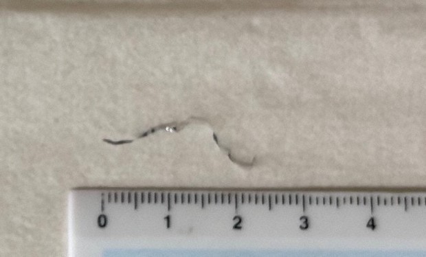 給食の汁物に針金?混入　児童が発見、体調不良者なし　佐賀の小学校