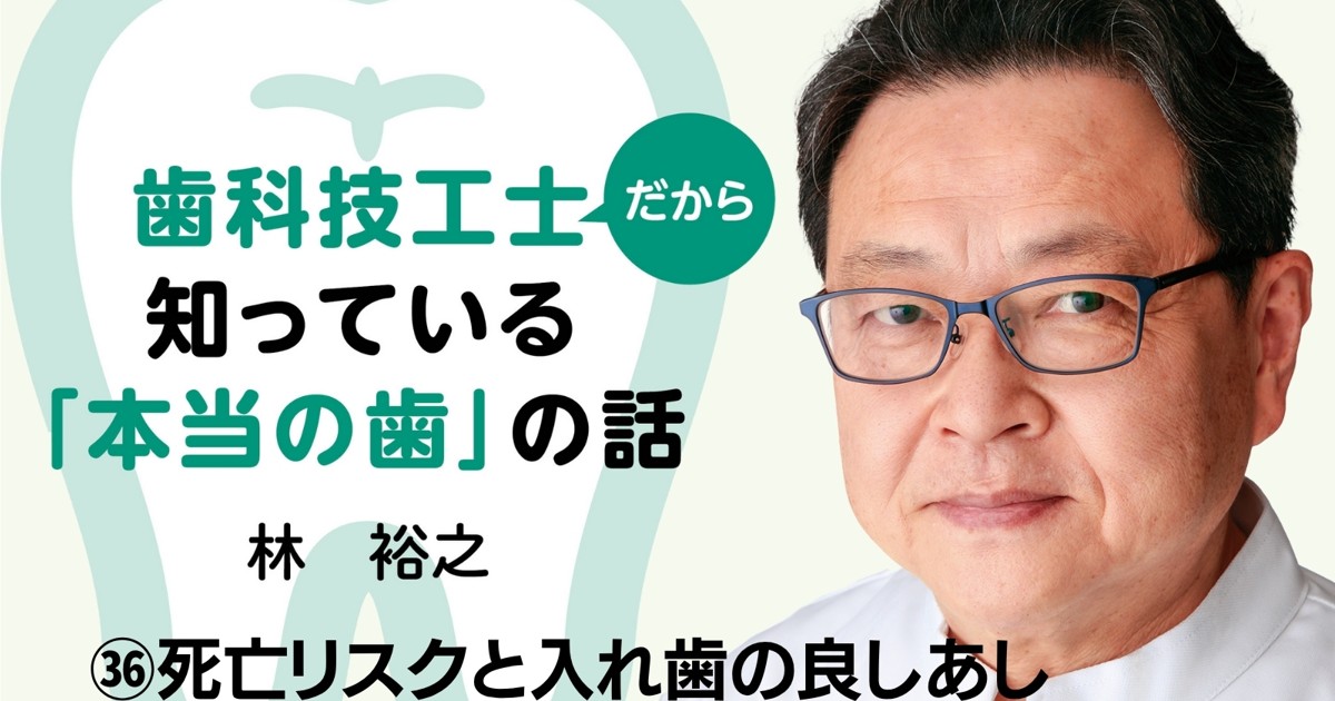 歯科技工士だから知っている「本当の歯」の話：㊱死亡リスクと入れ歯の