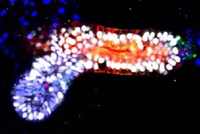 iPS細胞を用いて作製された肝臓の「ミニ臓器（オルガノイド）」＝大阪大提供