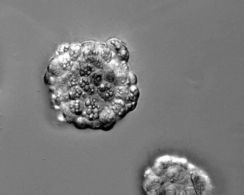 肝臓病は食べて治す シイタケ菌糸体エキス 肝機能障害を倒す\