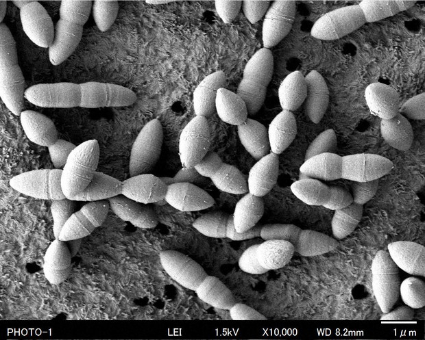 Japan research team discovers new gut bacterium that boosts cancer