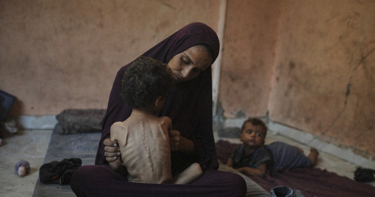 Editorial: Using food as a 'weapon' inhumane as Gaza faces mass starvation