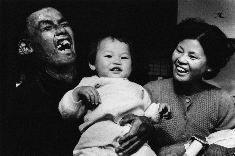 戦後80年：東松照明×土門拳 「被爆」それぞれの視点で 脅威を抽象的