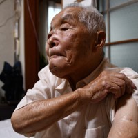 沖縄戦に兵士として送られ、多くの仲間を失った山下和明さん。左腕には米軍の銃撃で負った傷痕が残る＝大分県国東市で2025年8月5日午後6時26分、遠藤孝康撮影