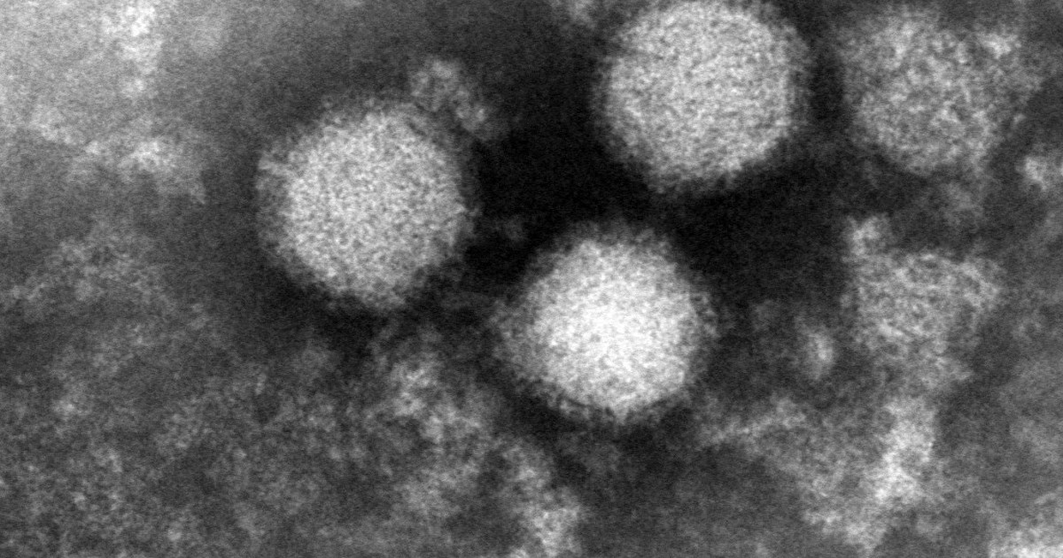 マダニが媒介する感染症「SFTS」　千葉県内の猫で初確認