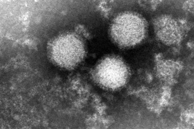 「重症熱性血小板減少症候群（SFTS）」を引き起こすウイルスの電子顕微鏡写真＝国立健康危機管理研究機構提供