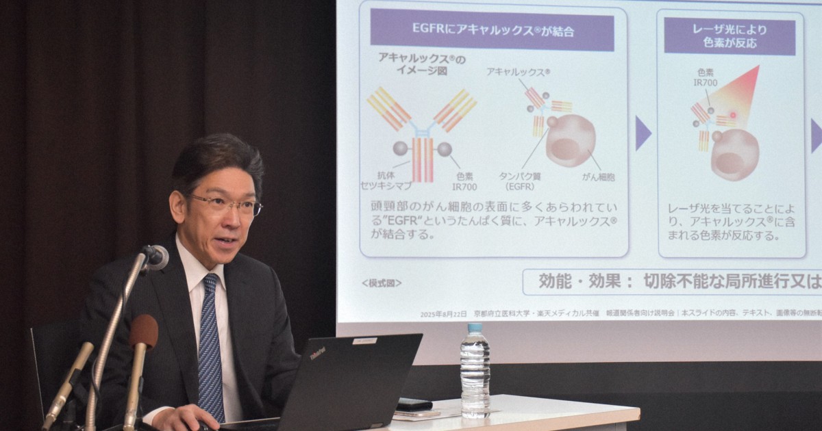 ＜1分で解説＞光免疫療法とがん治療薬の併用　最終治験を開始