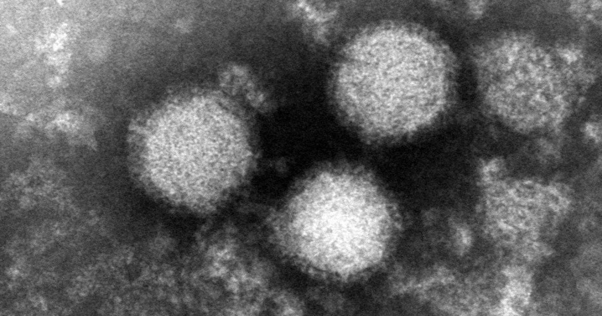 SFTSウイルスの電子顕微鏡写真＝国立健康危機管理研究機構提供
