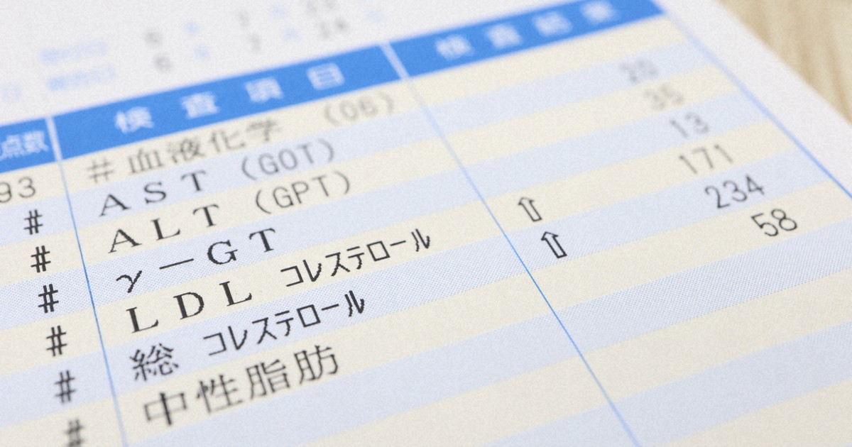 ＝ゲッティ