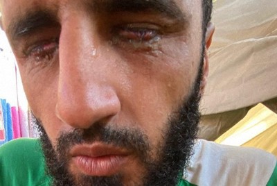イスラエル軍の暴行で両目を失明したマフムード・アブフールさん＝パレスチナ自治区ガザ地区中部ザワイダで2025年10月28日、サミ・アブサーリム撮影