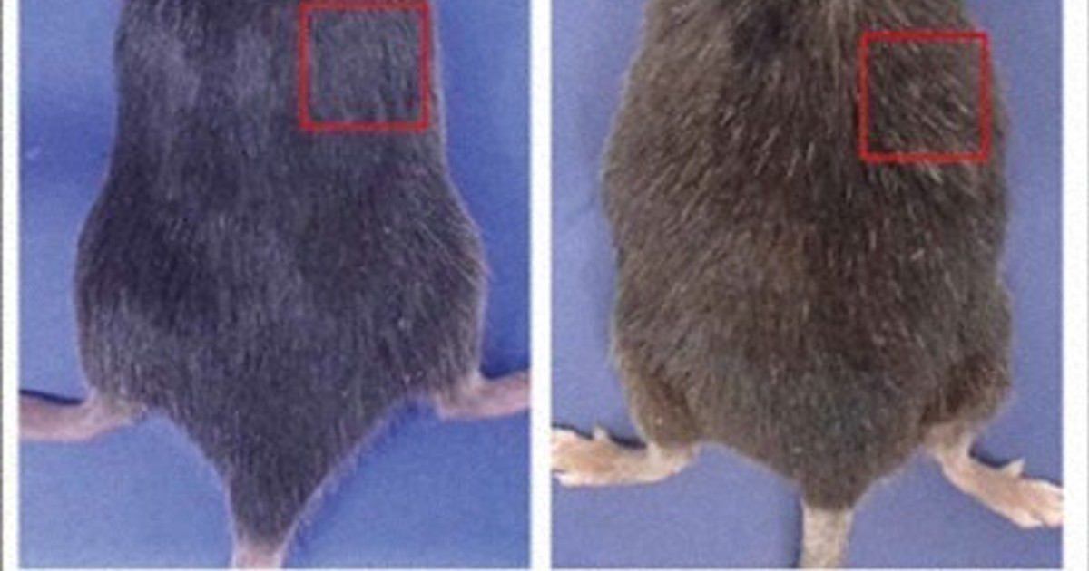 News in Easy English: Gray hair may help protect against cancer, Japanese study finds