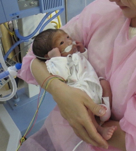 赤ちゃん 髪の毛なかなか生えないなあ〜🙂‍↔️🙂‍↔️ #1歳5ヶ月👦 #髪の毛の