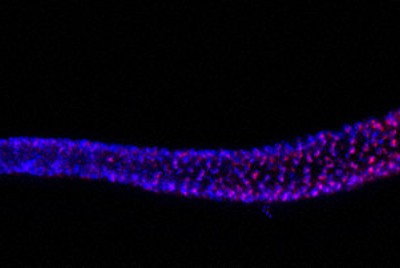 線虫の生殖細胞（青）で発現するテロメレースRNA（赤）＝理化学研究所提供