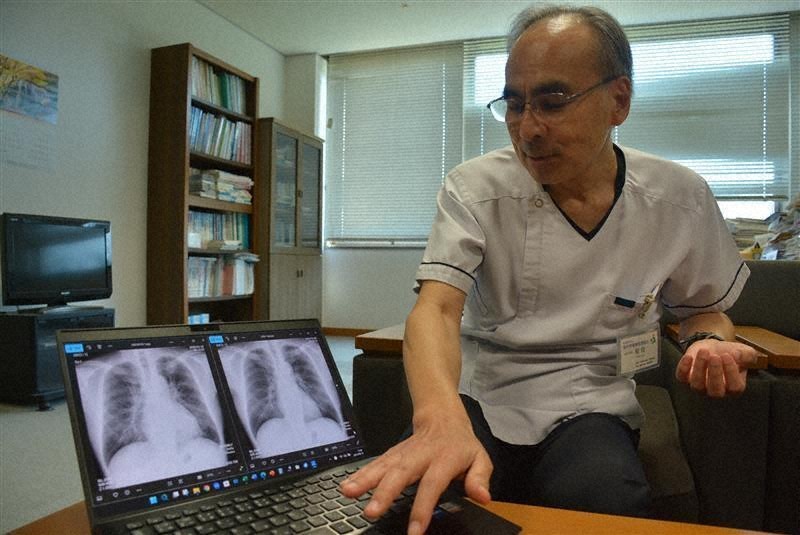 くらしナビ・医療：がん検診専門家はステージ4／上 昨年の写真では発見