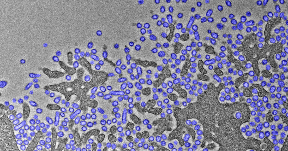 Avian flu virus can remain infectious in milk for over 5 months: Tokyo Univ. researchers （2025/12/5）