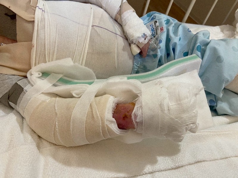 この世で最も残酷」希少難病と生きる8歳 家族が切望する社会の理解