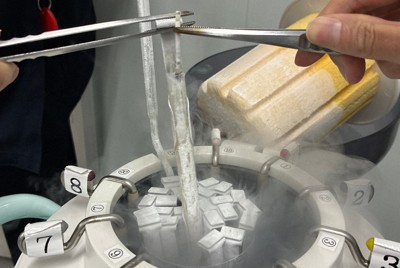 液体窒素の入った凍結保存タンクに収められた胚＝石川智基医師提供（画像の一部を加工しています）