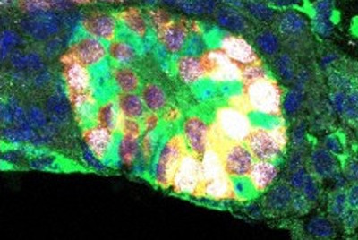 人工的に作ったマウスの精子になる前の精原幹細胞様細胞（白）の顕微鏡画像＝大阪大提供