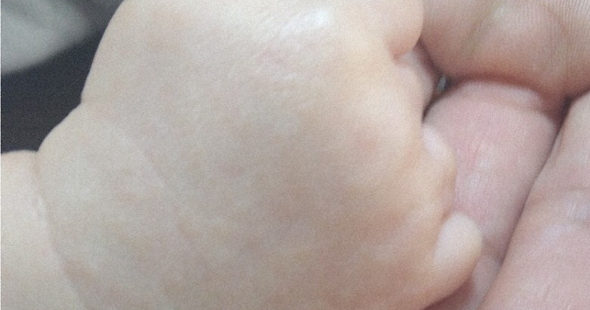 Epidural labor spreads slowly in Japan as pain relief emerges as human right