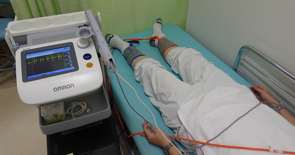 「足梗塞」壊死や切断も　映画「国宝」でも話題　治療・予防法は